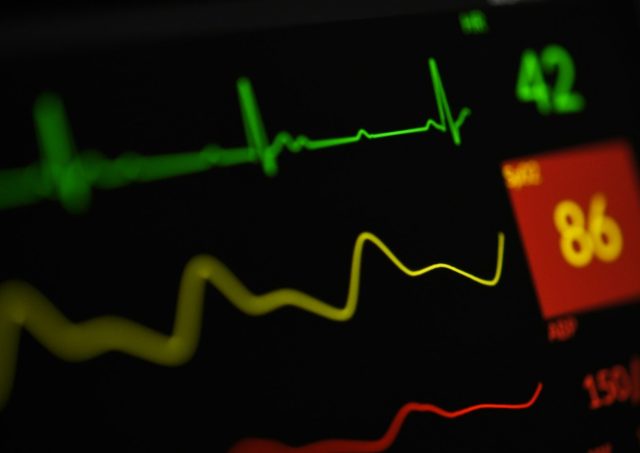 a close up of a monitor screen with a heart beat